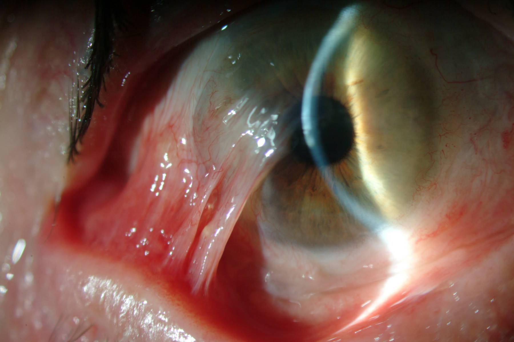 maxresdefault_compressed